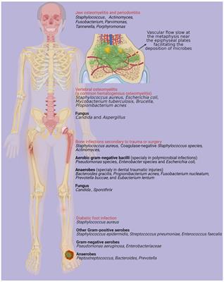 Mini Review Therapeutic Strategies Targeting for Biofilm and Bone Infections